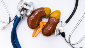 Read more about the article Diabetic Nephropathy: How Diabetes Affects Your Kidneys?